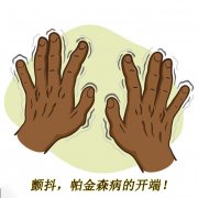 顫抖，帕金森病的開(kāi)端 帕金森的癥狀有哪些